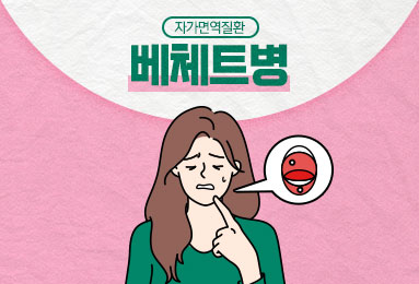 자가면역질환
베체트병